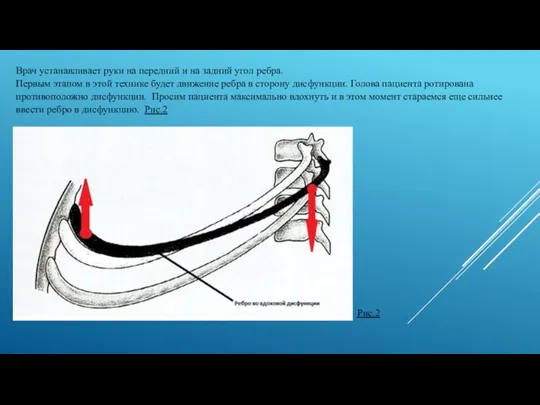 Врач устанавливает руки на передний и на задний угол ребра.