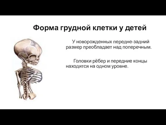 Форма грудной клетки у детей У новорожденных передне-задний размер преобладает