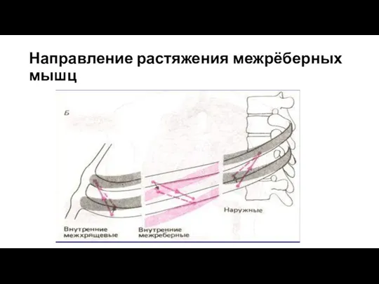 Направление растяжения межрёберных мышц