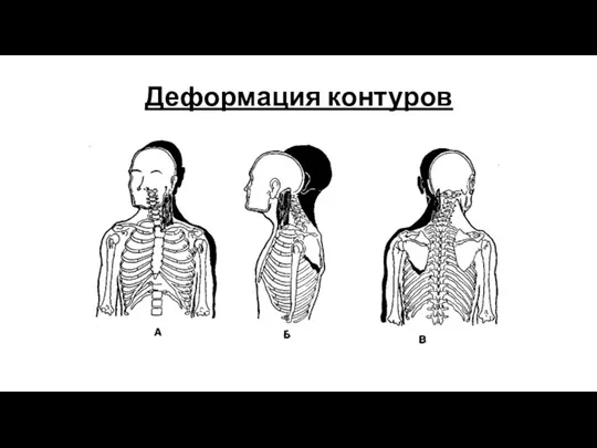 Деформация контуров