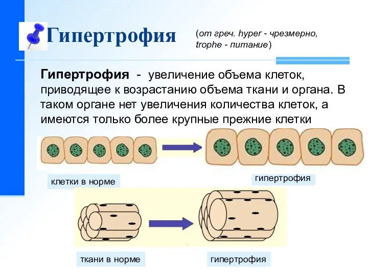 Гипертрофия клетки в норме гипертрофия гипертрофия ткани в норме Гипертрофия - увеличение объема