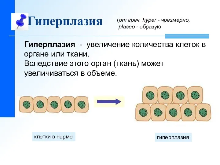 Гиперплазия клетки в норме гиперплазия Гиперплазия - увеличение количества клеток в органе или