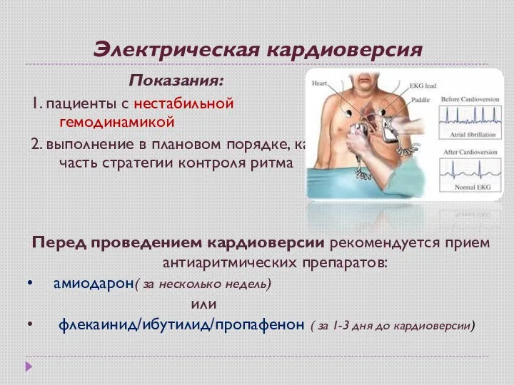 Электрическая кардиоверсия Показания: 1. пациенты с нестабильной гемодинамикой 2. выполнение