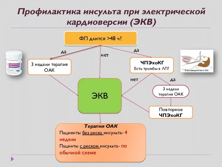 Профилактика инсульта при электрической кардиоверсии (ЭКВ) ФП длится >48 ч?