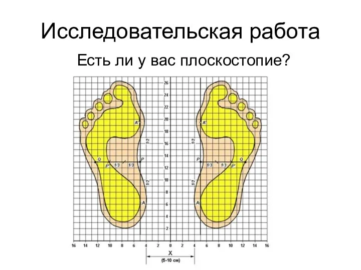 Исследовательская работа Есть ли у вас плоскостопие?