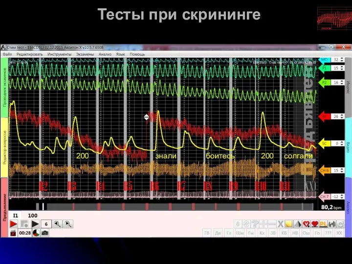 Тесты при скрининге 200 200 знали солгали боитесь