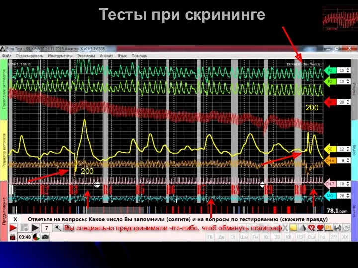 Тесты при скрининге 200 200 Вы специально предпринимали что-либо, чтоб обмануть полиграф