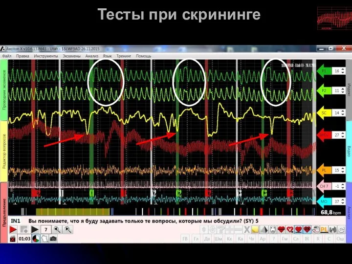 Тесты при скрининге