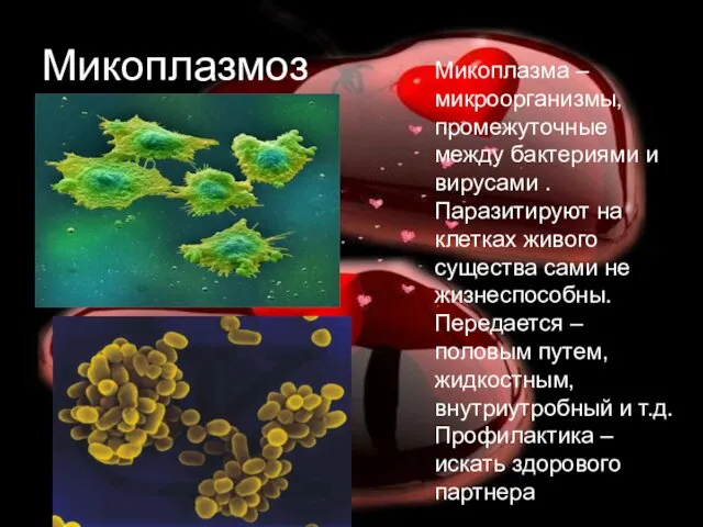 Микоплазмоз Микоплазма – микроорганизмы, промежуточные между бактериями и вирусами .