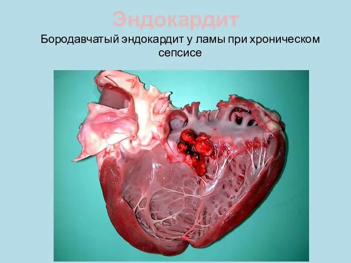 Эндокардит Бородавчатый эндокардит у ламы при хроническом сепсисе