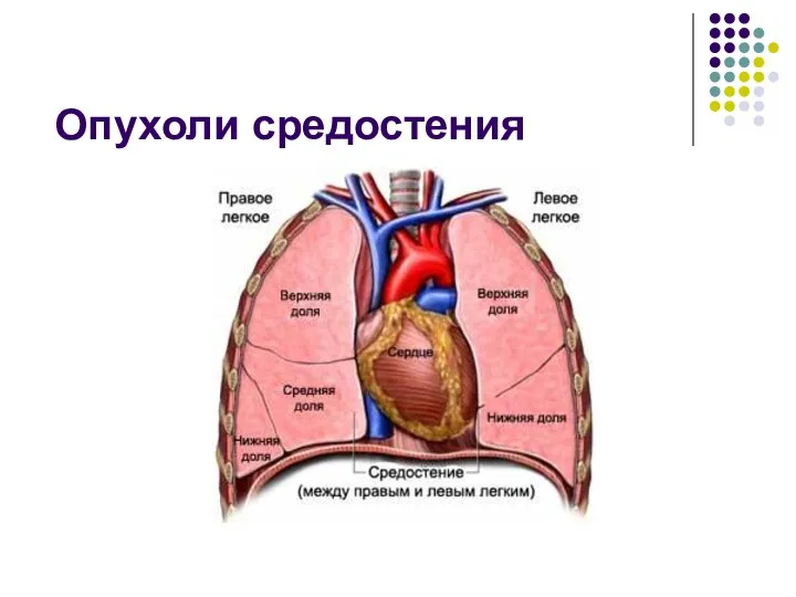 Опухоли средостения