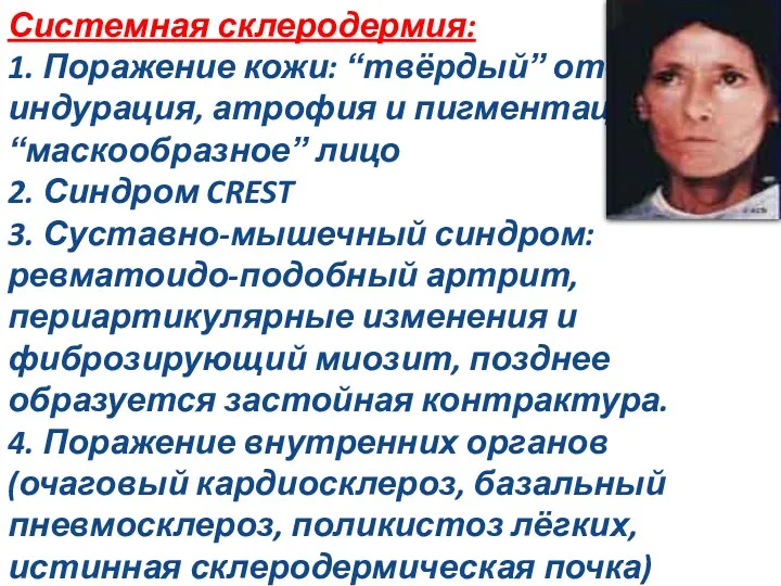 Системная склеродермия: 1. Поражение кожи: “твёрдый” отёк, индурация, атрофия и