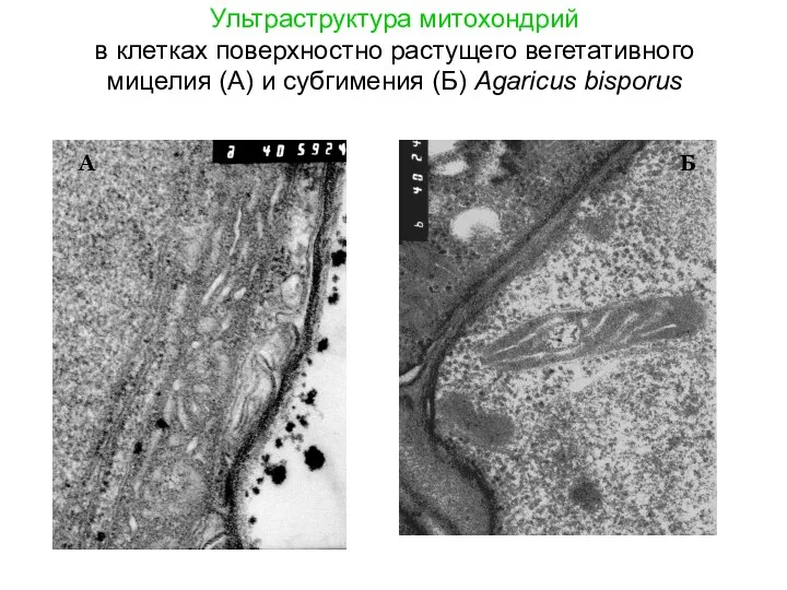 Ультраструктура митохондрий в клетках поверхностно растущего вегетативного мицелия (А) и субгимения (Б) Agaricus bisporus А Б