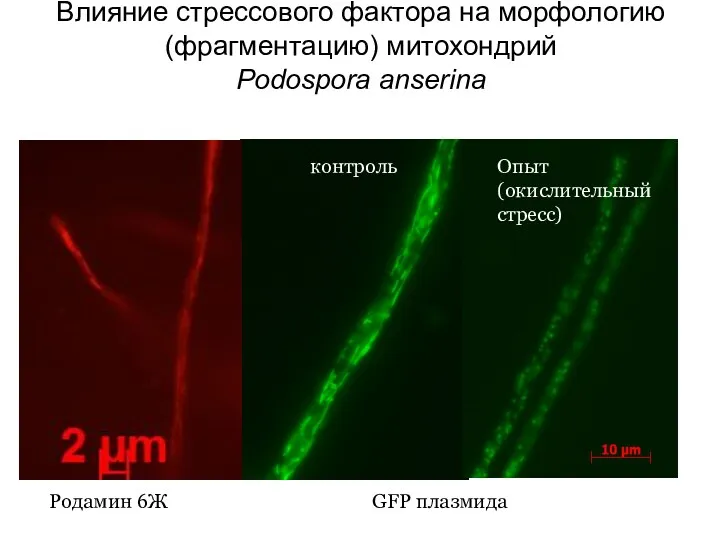 Влияние стрессового фактора на морфологию (фрагментацию) митохондрий Podospora anserina Родамин