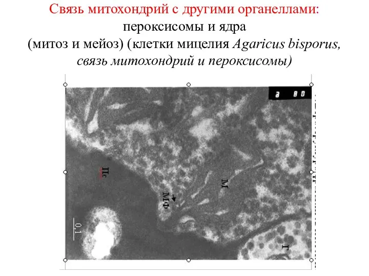 Связь митохондрий с другими органеллами: пероксисомы и ядра (митоз и