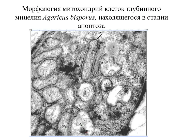 Морфология митохондрий клеток глубинного мицелия Agaricus bisporus, находящегося в стадии апоптоза