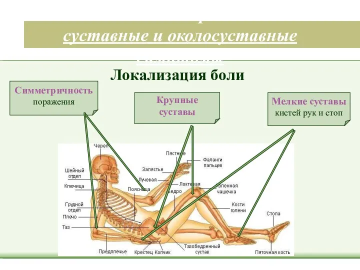 Клинические признаки – суставные и околосуставные симптомы Мелкие суставы кистей