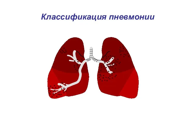 Классификация пневмонии