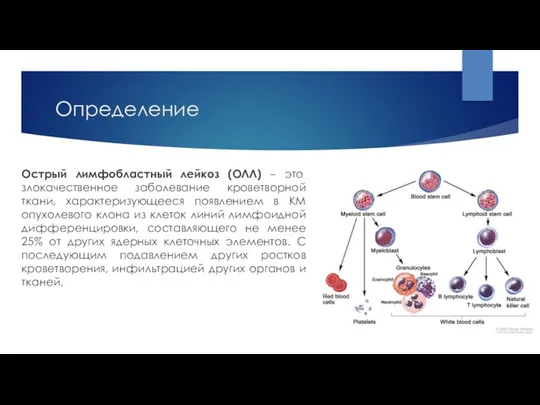 Определение Острый лимфобластный лейкоз (ОЛЛ) – это злокачественное заболевание кроветворной ткани, характеризующееся появлением