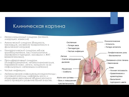 Клиническая картина Интоксикационный синдром (астения, лихорадка, кахексия) Анемический синдром (бледность,