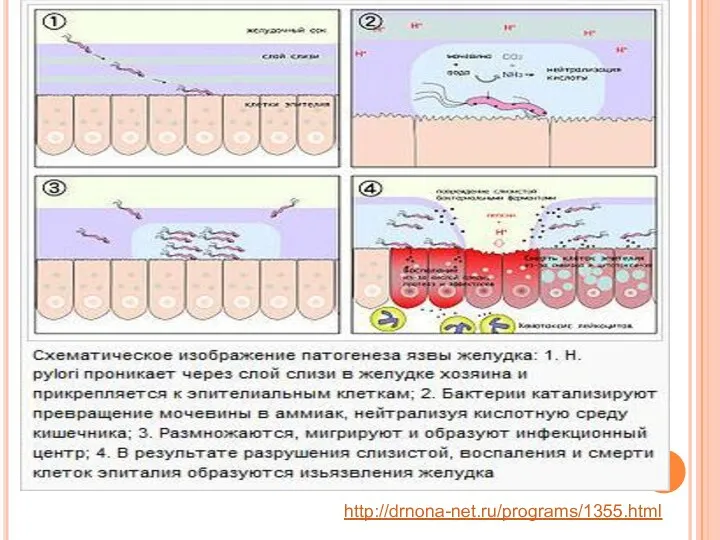 http://drnona-net.ru/programs/1355.html