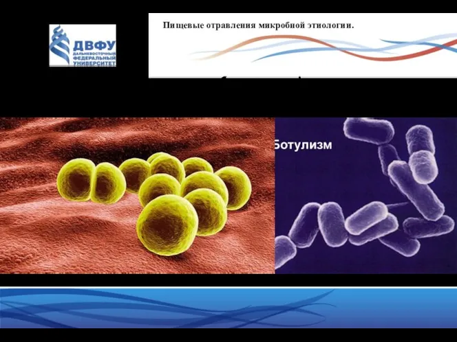 Пищевые отравления микробной этиологии. К пищевым интоксикациям относятся ботулизм и