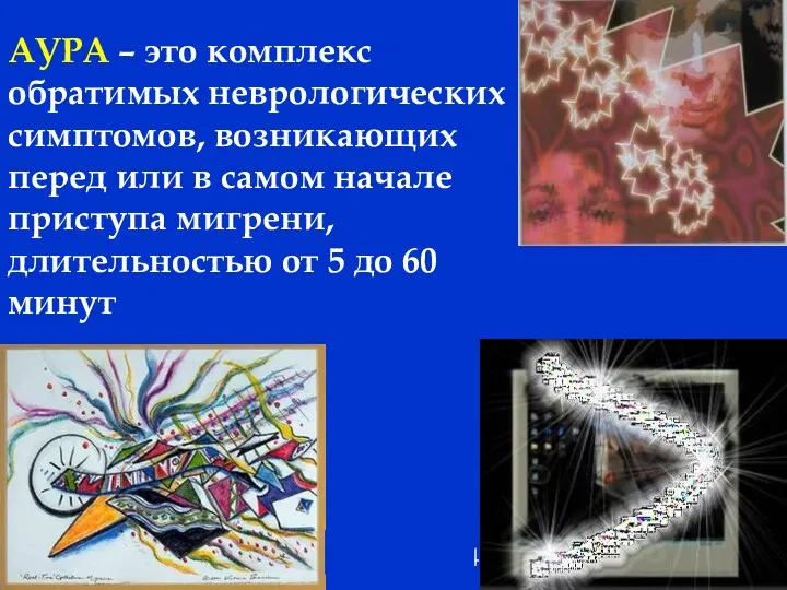 Амелин А.В. 2004 АУРА – это комплекс обратимых неврологических симптомов,