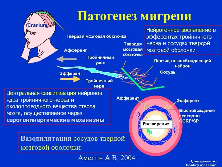 Амелин А.В. 2004 Патогенез мигрени Efferent Адаптировано из Goadsby and