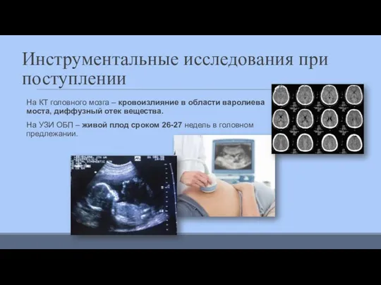 Инструментальные исследования при поступлении На КТ головного мозга – кровоизлияние