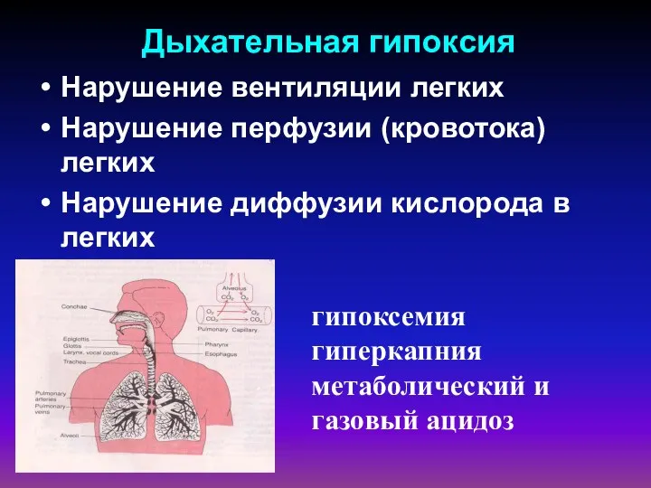 Дыхательная гипоксия Нарушение вентиляции легких Нарушение перфузии (кровотока) легких Нарушение