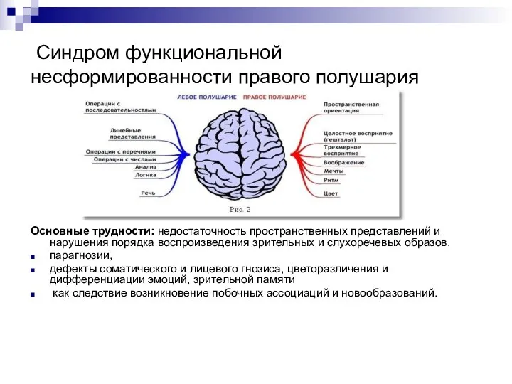 Синдром функциональной несформированности правого полушария Основные трудности: недостаточность пространственных представлений