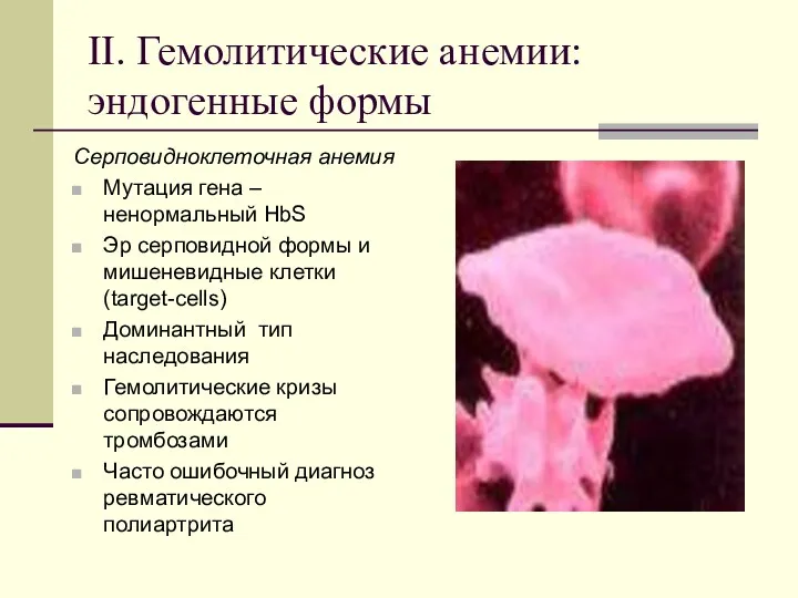 II. Гемолитические анемии: эндогенные формы Серповидноклеточная анемия Мутация гена –