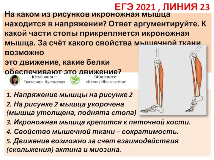 На каком из рисунков икроножная мышца находится в напряжении? Ответ аргументируйте. К какой