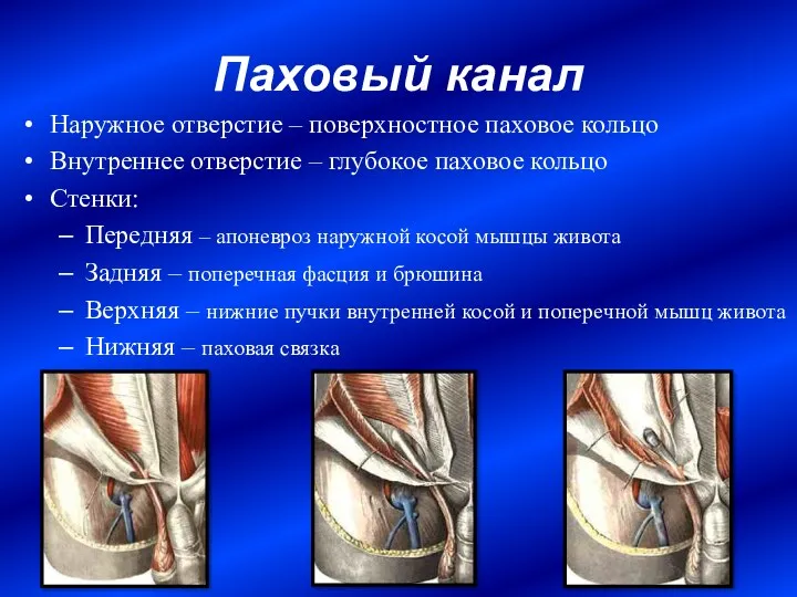 Паховый канал Наружное отверстие – поверхностное паховое кольцо Внутреннее отверстие