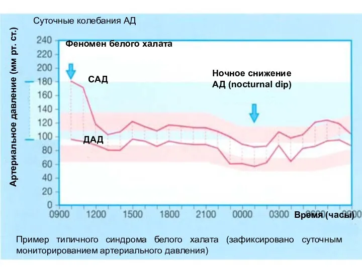 Время (часы) Феномен белого халата Ночное снижение АД (nocturnal dip) САД ДАД Артериальное