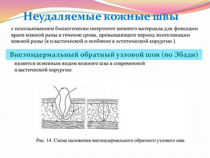 с использованием биологически инертного шовного материала для фиксации краев кожной