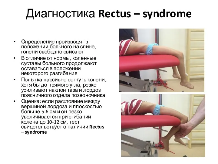 Диагностика Rectus – syndrome Определение производят в положении больного на спине, голени свободно