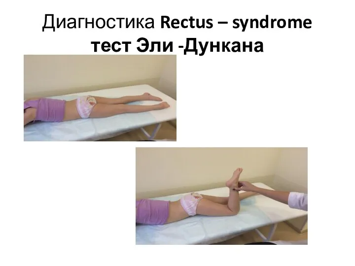 Диагностика Rectus – syndrome тест Эли -Дункана