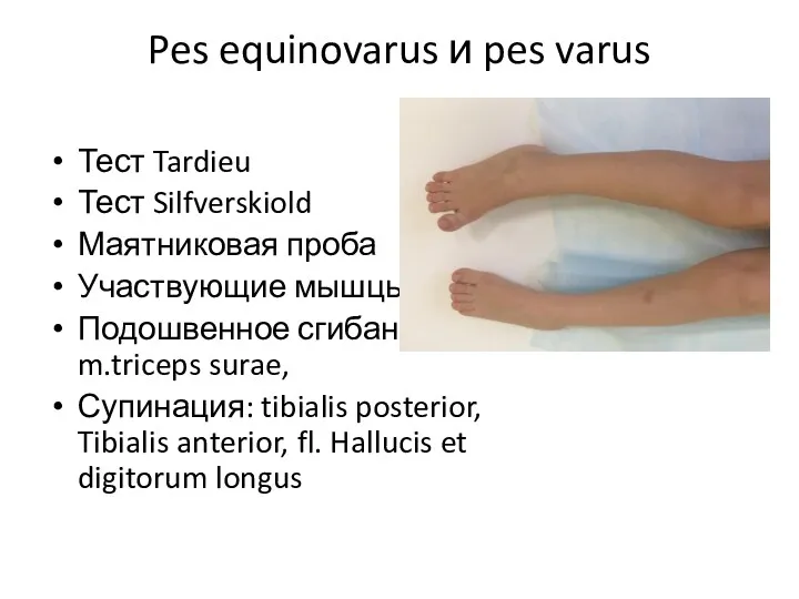 Pes equinovarus и pes varus Тест Tardieu Тест Silfverskiold Маятниковая проба Участвующие мышцы: