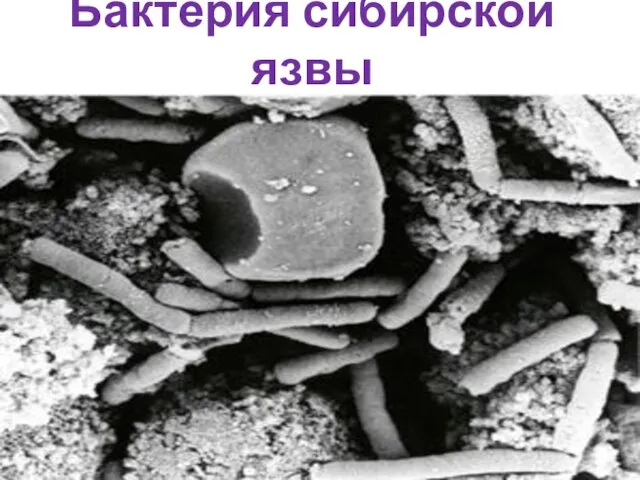 Бактерия сибирской язвы