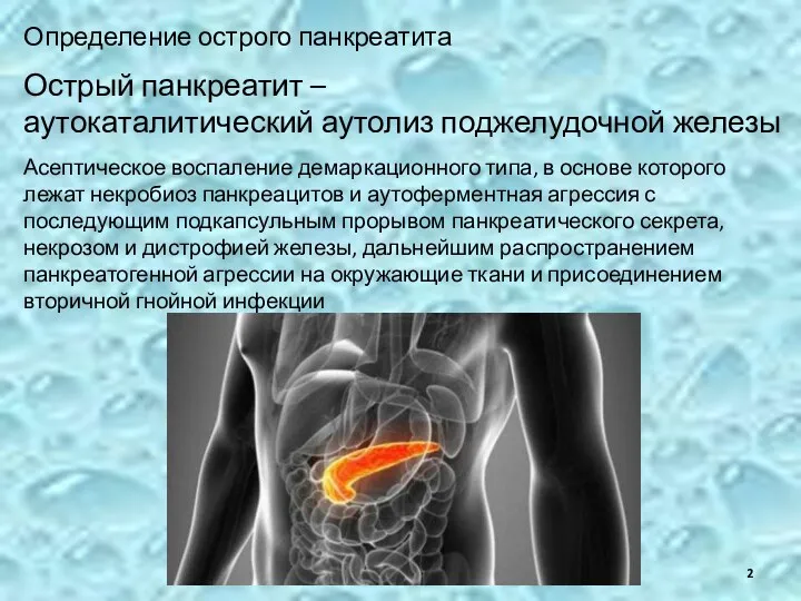 Определение острого панкреатита Острый панкреатит – аутокаталитический аутолиз поджелудочной железы