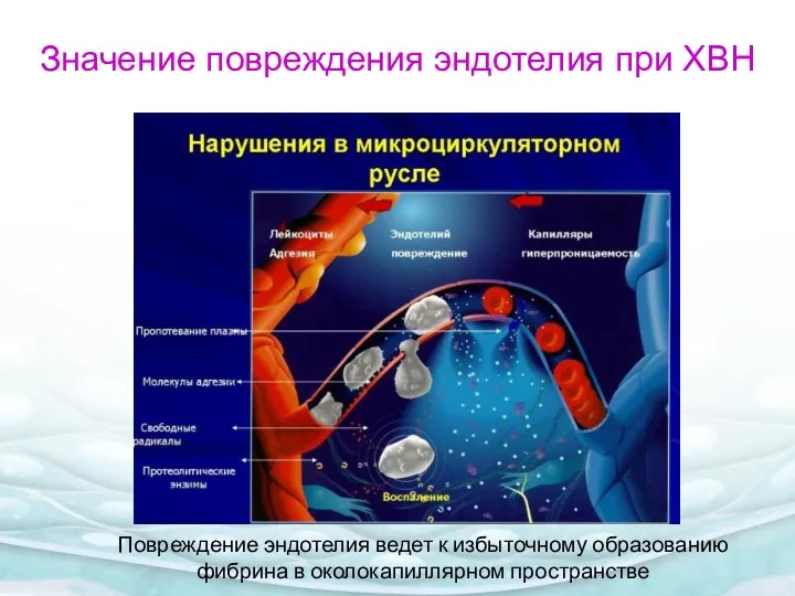 Повреждение эндотелия ведет к избыточному образованию фибрина в околокапиллярном пространстве Значение повреждения эндотелия при ХВН