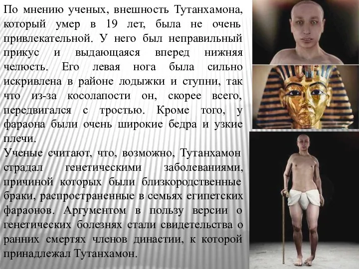 По мнению ученых, внешность Тутанхамона, который умер в 19 лет, была не очень