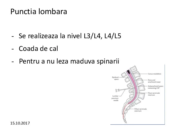 Punctia lombara Se realizeaza la nivel L3/L4, L4/L5 Coada de