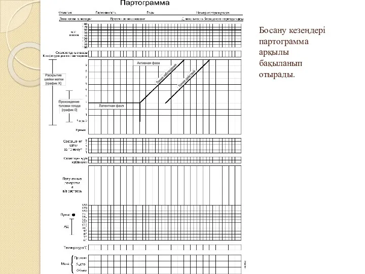 Босану кезеңдері партограмма арқылы бақыланып отырады.