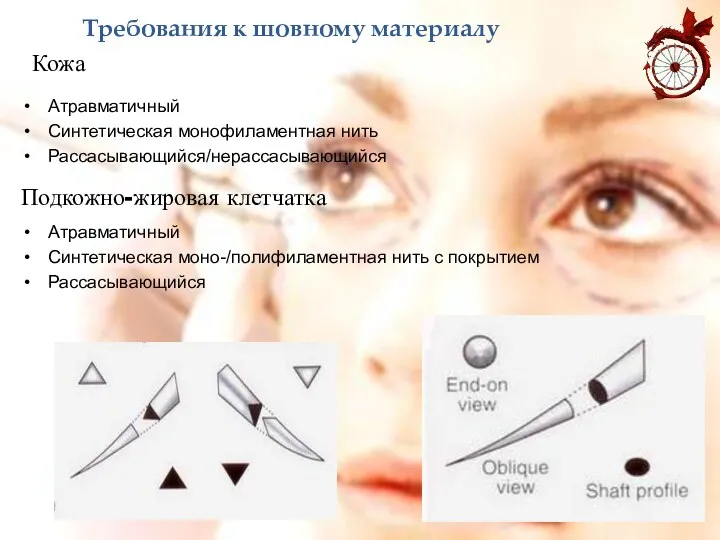 Требования к шовному материалу Атравматичный Синтетическая монофиламентная нить Рассасывающийся/нерассасывающийся Атравматичный