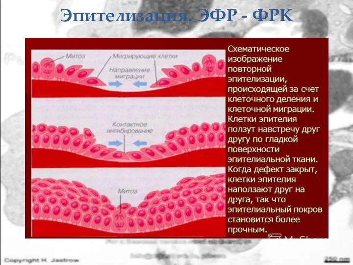 Эпителизация. ЭФР - ФРК