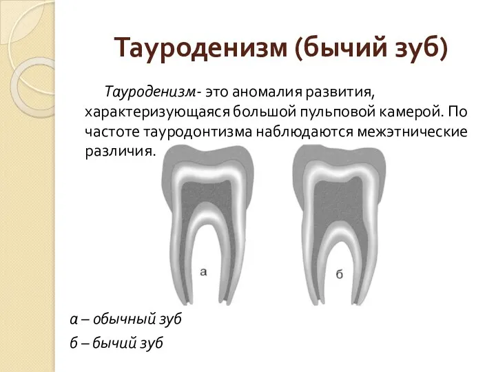 Тауроденизм (бычий зуб) Тауроденизм- это аномалия развития, характеризующаяся большой пульповой камерой. По частоте