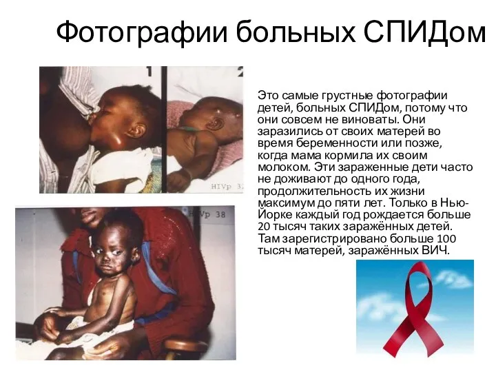 Фотографии больных СПИДом Это самые грустные фотографии детей, больных СПИДом, потому что они