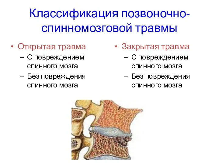 Классификация позвоночно-спинномозговой травмы Открытая травма С повреждением спинного мозга Без повреждения спинного мозга
